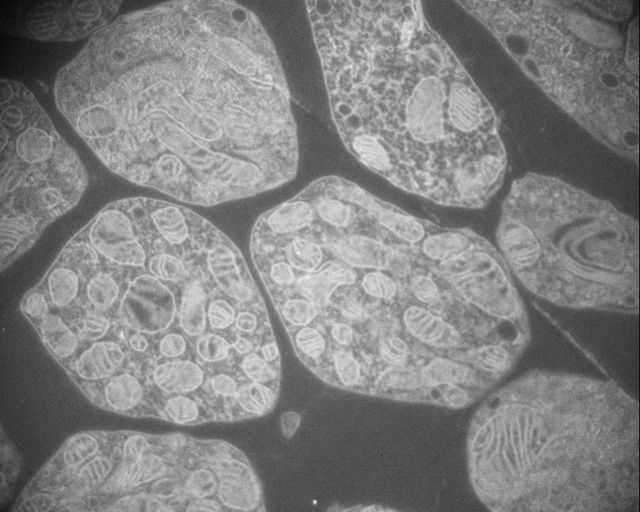 Bovine photoreceptor cell (cone inner segments).  (Freeze Substitution)