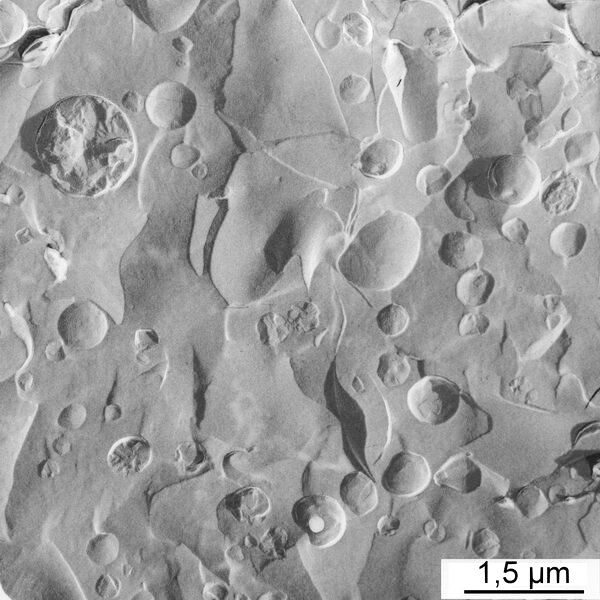 Commercial skin cream (freeze-fracture TEM)